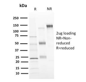 SDS-PAGE analysis of purified, BSA-free CD73 antibody (clone NT5E/2646) as confirmation of integrity and purity.