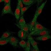 Immunofluorescence staining of human U-87 MG cells with CD73 antibody (green, clone NT5E/2646) and Reddot nuclear stain (red).