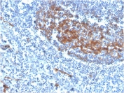 IHC staining of FFPE human tonsil tissue with biotinylated CD73 antibody (clone NT5E/2646). HIER: boil tissue sections in pH9 10mM Tris with 1mM EDTA for 10-20 min and allow to cool before testing.