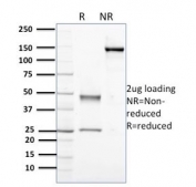 SDS-PAGE analysis of purified, BSA-free Nucleophosmin antibody (clone NPM1/3398) as confirmation of integrity and purity.