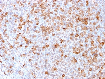 IHC staining of FFPE human tonsil with CD3e antibody (clone C3e/3171R). HIER: boil tissue sections in pH 9 10mM Tris with 1mM EDTA for 10-20 min and allow to cool before testing.~