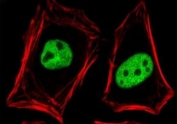 Immunofluorescence staining of PFA-fixed human MCF-7 cells with MSH6 antibody (green, clone MST6-2) and Phalloidin (red).