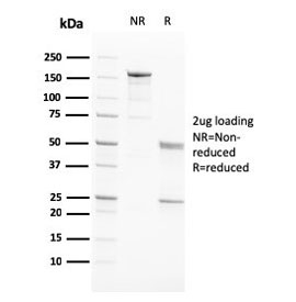 SDS-PAGE analysis of purified, BSA-free PAPPA antibody (