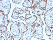 IHC staining of FFPE human placenta with PAPPA antibody (clone PAPPA/2717). HIER: boil tissue sections in pH6, 10mM citrate buffer, for 10-20 min and allow to cool before testing.