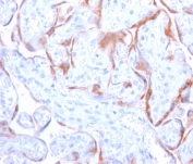 IHC staining of FFPE human placenta with PAPP-A antibody (clone PAPPA/2718). HIER: boil tissue sections in pH6, 10mM citrate buffer, for 10-20 min and allow to cool before testing.