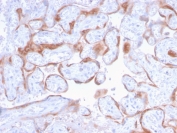 IHC staining of FFPE human placenta with PAPP-A antibody (clone PAPPA/2718). HIER: boil tissue sections in pH6, 10mM citrate buffer, for 10-20 min and allow to cool before testing.