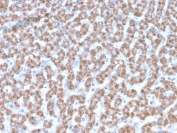 IHC testing of FFPE human liver tissue with Prohibitin antibody (clone PHB/3193). Required HIER: boil tissue sections in pH6, 10mM citrate buffer, for 10-20 min followed by cooling at RT for 20 min.