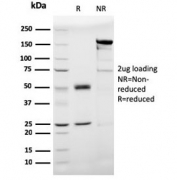 SDS-PAGE analysis of purified, BSA-free Prohibitin antibody (clone PHB/3193) as confirmation of integrity and purity.