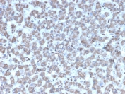 IHC testing of FFPE human liver tissue with Prohibitin antibody (clone PHB/3194). Required HIER: boil tissue sections in pH6, 10mM citrate buffer, for 10-20 min followed by cooling at RT for 20 min.