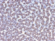 IHC testing of FFPE human liver tissue with Prohibitin antibody (clone PHB/3194). Required HIER: boil tissue sections in pH6, 10mM citrate buffer, for 10-20 min followed by cooling at RT for 20 min.