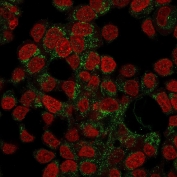 Immunofluorescence staining of human HepG2 cells with Prohibitin antibody (green, clone PHB/3194) and Reddot nuclear stain (red).