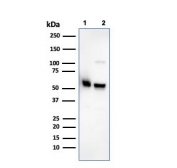 Western blot testing of human 1) K562 and 2) PC-3 cell lysate with SERBP1 antibody. Predicted molecular weight ~45 kDa but observed at 45-60 kDa.