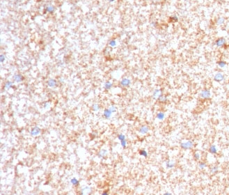 IHC staining of FFPE human brain with Serum Amyloid P antibody (clone SMPC-1). HIER: boil tissue sections in pH 9 10mM Tris with 1mM EDTA for 10-20 min and allow to cool before testing.