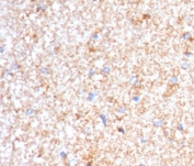 IHC staining of FFPE human brain with Serum Amyloid P antibody (clone SMPC-1). HIER: boil tissue sections in pH 9 10mM Tris with 1mM EDTA for 10-20 min and allow to cool before testing.