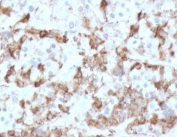 IHC testing of FFPE human pituitary tissue with PRL antibody (clone PLCN-1). Required HIER: boil tissue sections in pH 9 10mM Tris with 1mM EDTA for 10-20 min followed by cooling at RT for 20 min.