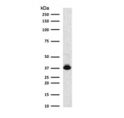 Western blot testing of human K562 cell lysate with Nucleophosmin antibody (clone NLPP1-1). Expected molecular weight ~38 kDa.