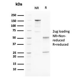 SDS-PAGE analysis of purified, BSA-free PAPP-A antibody (clone PAPPA/2715) as confirmation of integrity and purity.