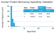 Analysis of HuProt(TM) microarray containing more than 19,000 full-length human proteins using Prohibitin antibody (clone PHB/3226). These results demonstrate the foremost specificity of the PHB/3226 mAb. Z- and S- score: The Z-score represents the strength of a signal that an antibody (in combination with a fluorescently-tagged anti-IgG secondary Ab) produces when binding to a particular protein on the HuProt(TM) array. Z-scores are described in units of standard deviations (SD's) above the mean value of all signals generated on that array. If the targets on the HuProt(TM) are arranged in descending order of the Z-score, the S-score is the difference (also in units of SD's) between the Z-scores. The S-score therefore represents the relative target specificity of an Ab to its intended target.