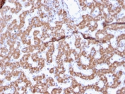 IHC testing of FFPE human liver tissue with Prohibitin antibody (clone PHB/3225). Required HIER: boil tissue sections in pH6, 10mM citrate buffer, for 10-20 min followed by cooling at RT for 20 min.