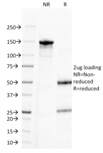 SDS-PAGE analysis of purified, BSA-free CD20 antibody (clone MS4A1/3411) as confirmation of integrity and purity.