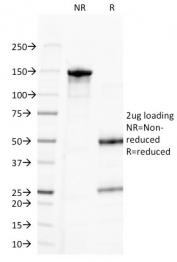 SDS-PAGE analysis of purified, BSA-free CD20 antibody (clone MS4A1/3411) as confirmation of integrity and purity.