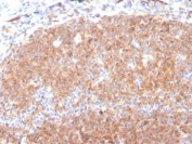 IHC staining of FFPE human tonsil with CD19 antibody (clone CD19/3117). HIER: boil tissue sections in pH 9 10mM Tris with 1mM EDTA for 10-20 min and allow to cool before testing.