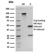 SDS-PAGE analysis of purified, BSA-free Prolactin antibody (clone PRL/2641) as confirmation of integrity and purity.