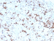 IHC testing of FFPE human pituitary tissue with Prolactin antibody (clone PRL/2641). Required HIER: boil tissue sections in pH6, 10mM citrate buffer, for 10-20 min followed by cooling at RT for 20 min.