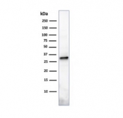 Western blot testing of human U937 cell lysate with Prolactin antibody (clone PRL/2641). Predicted molecular weight: ~25 kDa.