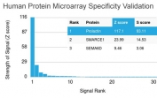 Analysis of HuProt(TM) microarray containing more than 19,000 full-length human proteins using Prolactin antibody (clone PRL/2642). These results demonstrate the foremost specificity of the PRL/2642 mAb. Z- and S- score: The Z-score represents the strength of a signal that an antibody (in combination with a fluorescently-tagged anti-IgG secondary Ab) produces when binding to a particular protein on the HuProt(TM) array. Z-scores are described in units of standard deviations (SD's) above the mean value of all signals generated on that array. If the targets on the HuProt(TM) are arranged in descending order of the Z-score, the S-score is the difference (also in units of SD's) between the Z-scores. The S-score therefore represents the relative target specificity of an Ab to its intended target.