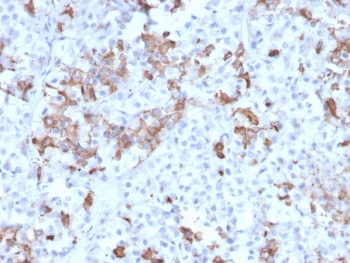 IHC testing of FFPE human pituitary tissue with Prolactin antibody (clone PRL/2642). Required HIER: boil tissue sections in pH6, 10mM citrate buffer, for 10-20 min followed by cooling at RT for 20 min.~