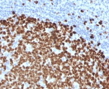 IHC testing of FFPE human tonsil and Thymidylate Synthase antibody (clone TYSY9-2). HIER: boil tissue sections in pH 9 10mM Tris with 1mM EDTA for 10-20 min followed by cooling at RT for 20 minutes.~