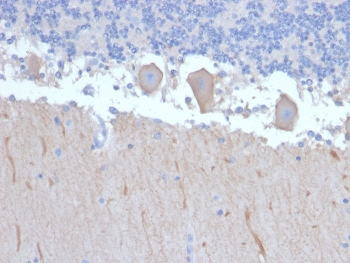 IHC staining of FFPE human brain with ATG5 antibody. HIER: boil tissue sections in pH 9 10mM Tris with 1mM EDTA for 10-20 min and allow to cool before testing.