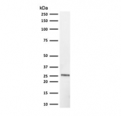 Western blot testing of human brain lysate with recombinant UchL1 antibody (clone rUBCE-L1). Predicted molecular weight ~25 kDa.