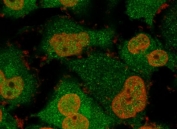 Immunofluorescent staining of permeabilized human T98G cells with recombinant UchL1 antibody cocktail (green, clone rUBCE-L1) and Nucspot (red).