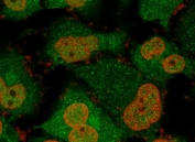 Immunofluorescent staining of permeabilized human T98G cells with recombinant UchL1 antibody cocktail (green, clone rUBCE-L1) and Nucspot (red).