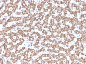 IHC testing of FFPE human liver tissue with PHB antibody (clone PHB/3229). Required HIER: boil tissue sections in pH6, 10mM citrate buffer, for 10-20 min followed by cooling at RT for 20 min.
