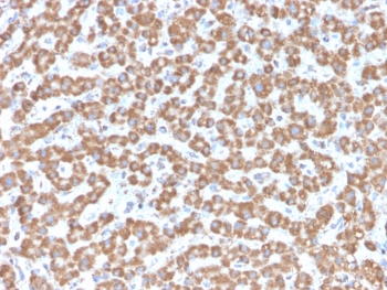 IHC testing of FFPE human liver tissue with