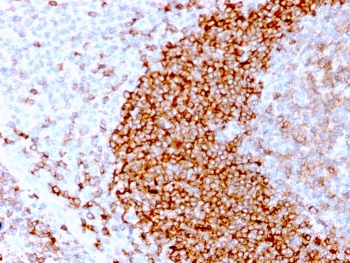 IHC staining of FFPE human tonsil tissue with recombinant CD79b antibody (clone IGB/3170R). HIER: boil tissue sections in pH 9 10mM Tris with 1mM EDTA for 10-20 min followed by cooling at RT for 20 min.~