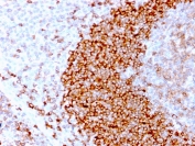 IHC staining of FFPE human tonsil tissue with recombinant CD79b antibody (clone IGB/3170R). HIER: boil tissue sections in pH 9 10mM Tris with 1mM EDTA for 10-20 min followed by cooling at RT for 20 min.