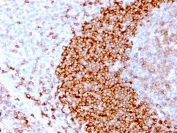 IHC staining of FFPE human tonsil tissue with recombinant CD79b antibody (clone IGB/3170R). HIER: boil tissue sections in pH 9 10mM Tris with 1mM EDTA for 10-20 min followed by cooling at RT for 20 min.