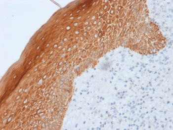 IHC staining of FFPE human skin with Cytokeratin 5/6/18 antibody (clone LP34). HIER: boil tissue sections in pH 9 10mM Tris with 1mM EDTA for 10-20 min and allow to cool before testing.~