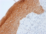 IHC staining of FFPE human skin with Cytokeratin 5/6/18 antibody (clone LP34). HIER: boil tissue sections in pH 9 10mM Tris with 1mM EDTA for 10-20 min and allow to cool before testing.