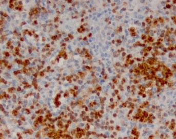 IHC staining of FFPE human lymph node with ANXA1 antibody (clone ANNX1-1). HIER: boil tissue sections in pH 9 10mM Tris with 1mM EDTA for 10-20 min and allow to cool before testing.~
