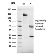 SDS-PAGE analysis of purified, BSA-free CD20 antibody (clone MS4A1/3409) as confirmation of integrity and purity.
