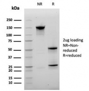 SDS-PAGE analysis of purified, BSA-free CD20 antibody (clone MS4A1/3410) as confirmation of integrity and purity.