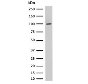 Western blot testing of human LNCaP cell lysate with FOLH1 antibody. Predicted molecular weight ~100 kDa.~