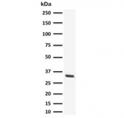 Western blot testing of NCCIT lysate with recombinant SOX2 antibody (clone SBX2-1R). Predicted molecular weight ~34 kDa.