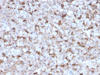 IHC testing of FFPE human pituitary tissue with Prolactin antibody (clone PRL/2643). Required HIER: boil tissue sections in pH6, 10mM citrate buffer, for 10-20 min followed by cooling at RT for 20 min.~