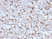 IHC testing of FFPE human pituitary tissue with Prolactin antibody (clone PRL/2643). Required HIER: boil tissue sections in pH6, 10mM citrate buffer, for 10-20 min followed by cooling at RT for 20 min.